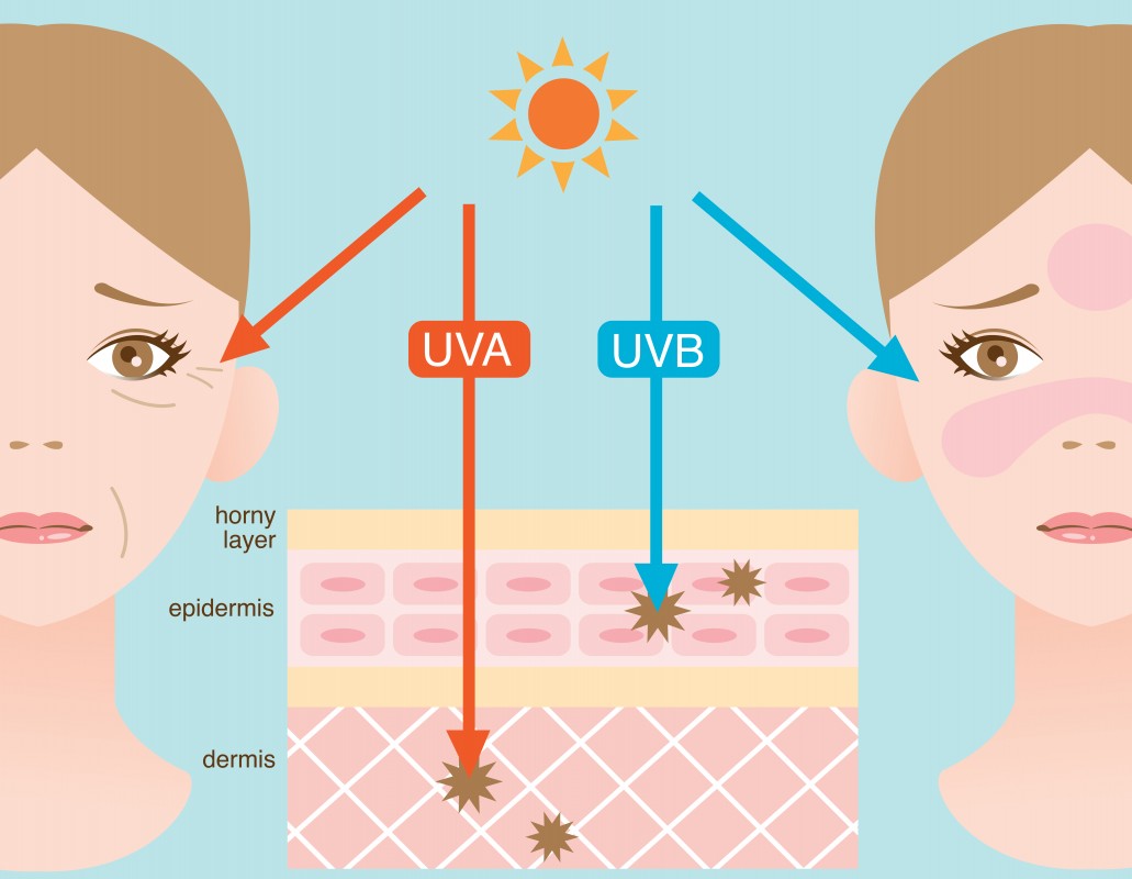 Effect van UV Straling op de huid